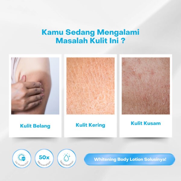 Whitening Body Lotion - Gambar 4
